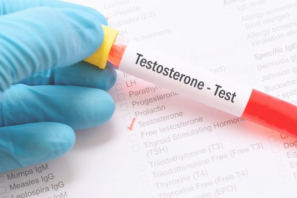 Measure testosterone with a testosterone test